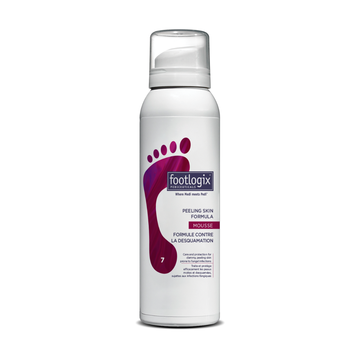 Peeling Skin on Feet: Causes and How to Treat It