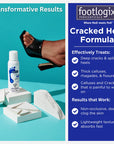 Footlogix Cracked Heel Formula (125ml)