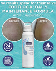 Footlogix Daily Maintenance Formula (125ml)