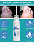 Footlogix Very Dry Skin Formula (125ml)